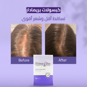 بريمادار كبسولات تساقط أقل وشعر أقوى