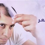 علاج نحل الشعر خيال! 3 شهور نتيجة لا تُصدق 6 علاج نحل الشعر كبسولات بريمادار لتقوية الشعر