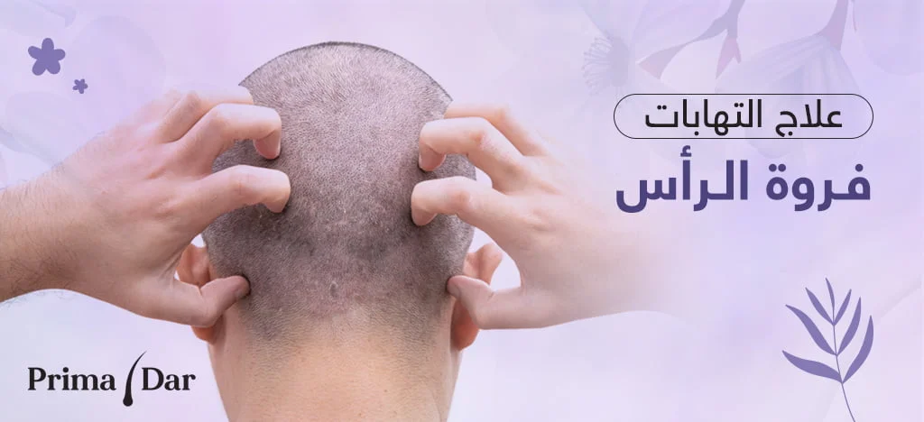 علاج التهابات فروة الرأس : وسائل التخلص من الحكة بريمادار