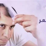 علاج نحل الشعر كبسولات بريمادار لتقوية الشعر