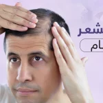 أفضل علاج لتكثيف الشعر من الأمام للرجال بريمادار