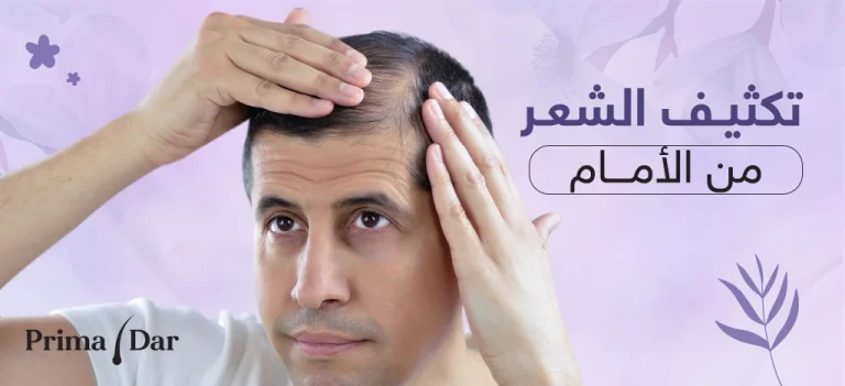 أفضل علاج لتكثيف الشعر من الأمام احجز! حتى الـ70 شباب دائم 9 أفضل علاج لتكثيف الشعر من الأمام للرجال بريمادار