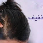 فيتامين للشعر الخفيف بريمادار اقوي فيتامينات لتطويل الشعر