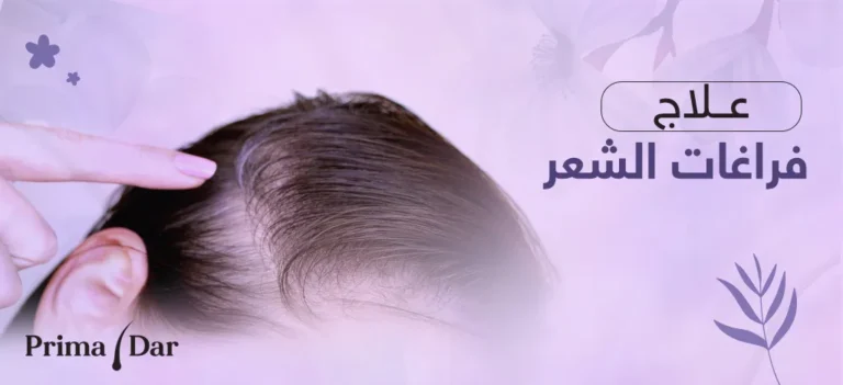 علاج فراغات الشعر و أفضل الطرق المستخدمة في تكثيف الشعر