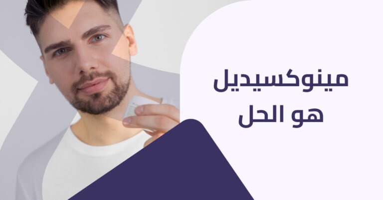 مينوكسيديل اكتشف كل ميزاته و عيوبه في دليلنا الشامل