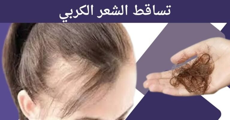 تساقط الشعر الكربي : 5 حلول فعالة للتغلب عليه الآن! 1 تساقط الشعر الكربي