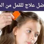 ما هو أفضل علاج للقمل من الصيدلية؟