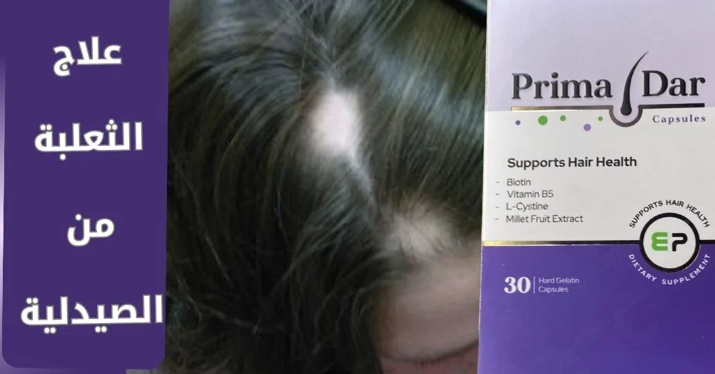 علاج الثعلبة من الصيدلية : 7 فوائد فعالة مع بريمادار 3 علاج الثعلبة من الصيدلية _ 7 فوائد فعّالة مع بريمادار