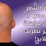 زراعة الشعر في مصر _ 7 حقائق مذهلة ستغير نظرتك للأبد!