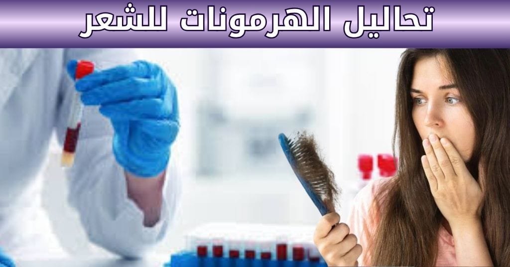 تحاليل الهرمونات للشعر