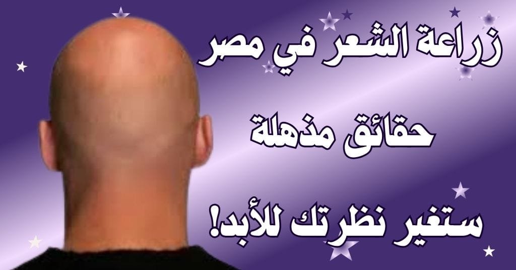 زراعة الشعر في مصر 6 حقائق مذهلة ستغير نظرتك للأبد!