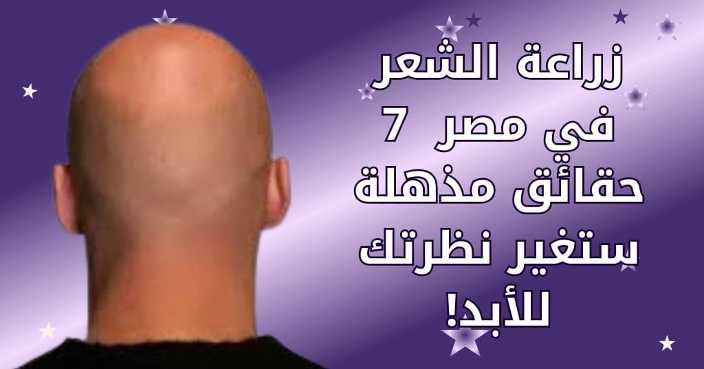 زراعة الشعر في مصر _ 7 حقائق مذهلة ستغير نظرتك للأبد!