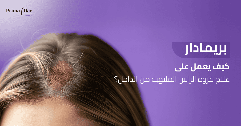 بريمادار كيف يعمل على علاج فروة الراس الملتهبة من الداخل؟