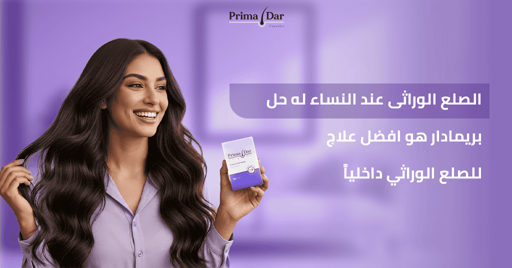 الصلع الوراثى عند النساء له حل! بريمادار هو افضل علاج للصلع الوراثي داخلياً