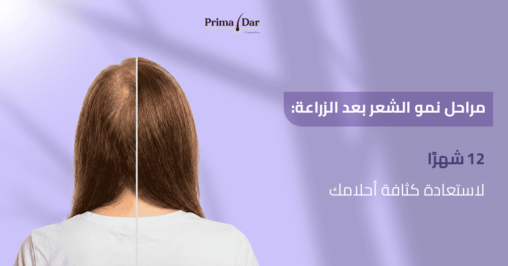 مراحل نمو الشعر بعد الزراعة : 12 شهرًا لاستعادة كثافة أحلامك! 1 مراحل نمو الشعر بعد الزراعة _ 12 شهرًا لاستعادة كثافة أحلامك!