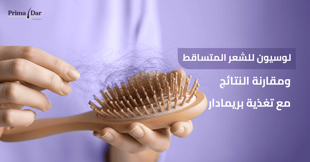 لوسيون-للشعر-المتساقط-ومقارنة-النتائج-مع-تغذية-بريمادار.jpg