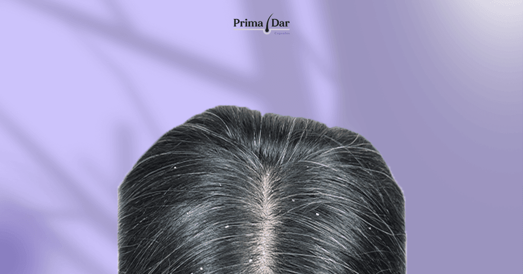 اسباب قشرة الشعر عند النساء وعلاقتها بنقص فيتامين ب5_