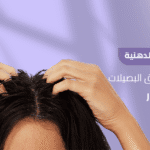 استمتع بنتائج ملموسة لعلاج القشرة الدهنية خلال 3 أشهر مع بريمادار 6 علاج القشرة الدهنية تخلص من خنق البصيلات بقوة بريمادار