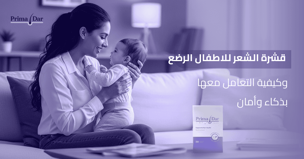 قشرة الشعر للاطفال الرضع وكيفية التعامل معها بذكاء وأمان